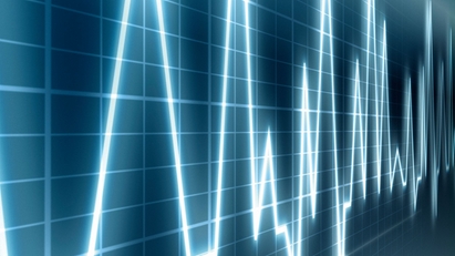 Gestores y equipos registradores de datos para monitorización de procesos